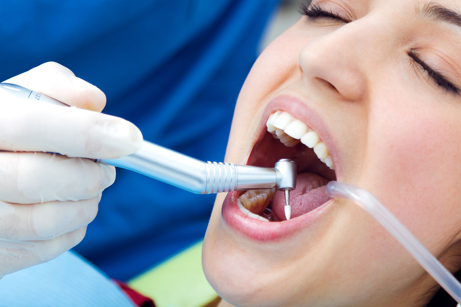 Pacjenci często pytają nas, czy to prawda, że aparat ortodontyczny może być winien pogorszeniu się stanu jamy ustnej. Jeśli jesteś ciekaw odpowiedzi, to koniecznie przeczytaj nasz artykuł.